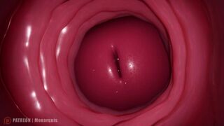 Internal Anal Insemination